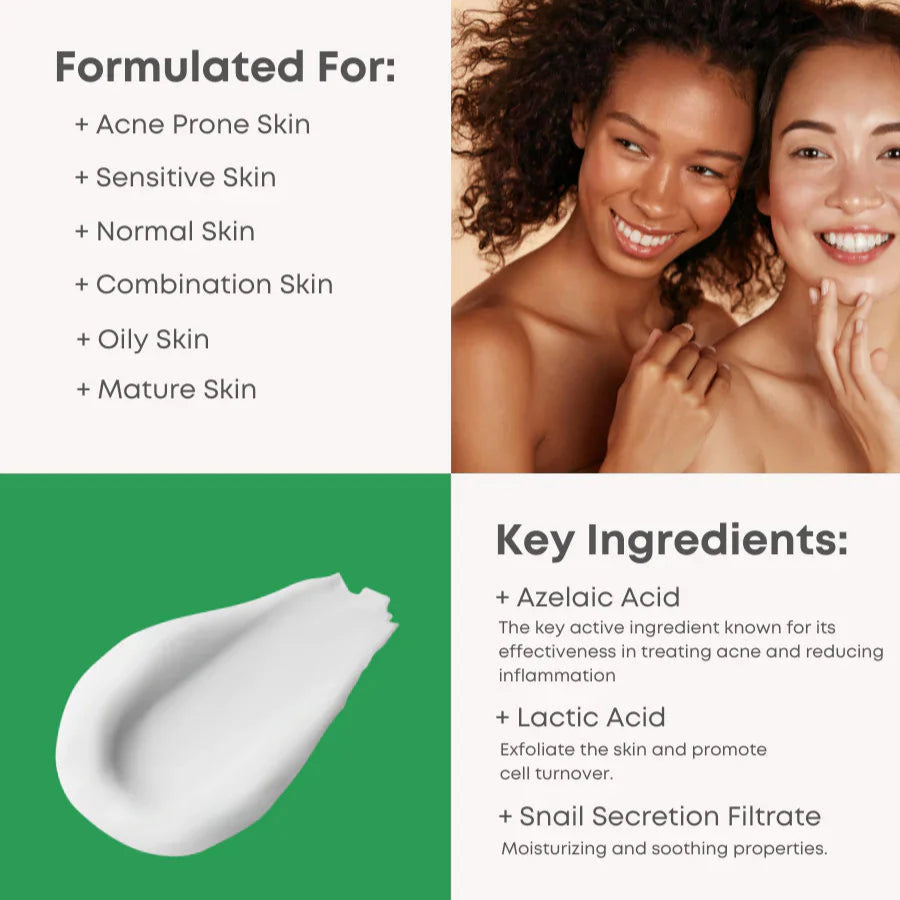 NINELESS_A-Control_Azelaic_Acid_Cream_(50ml)