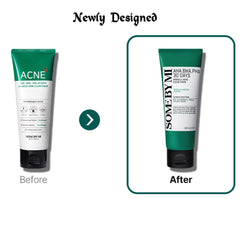 Some_By_Mi_AHA_BHA_PHA_30_Days_Miracle_Acne_Clear_Foam_100ml